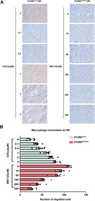 Knockdown of EIF4G1 in NSCLC induces CXCL8 secretion